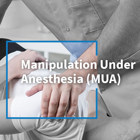 Manipulation under Anesthesia